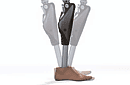 Beinprothese